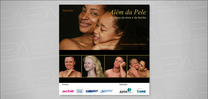Exposição "Além da Pele - A Beleza da Alma e da Família"